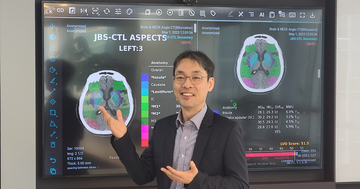 
  JLK CEO Dong-Min Kim showcasing their stroke AI solution
