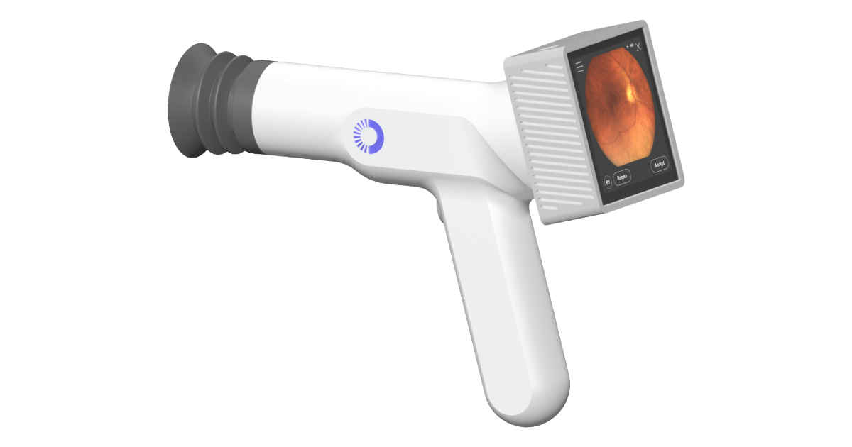 
  AI Optics Sentinel Camera

