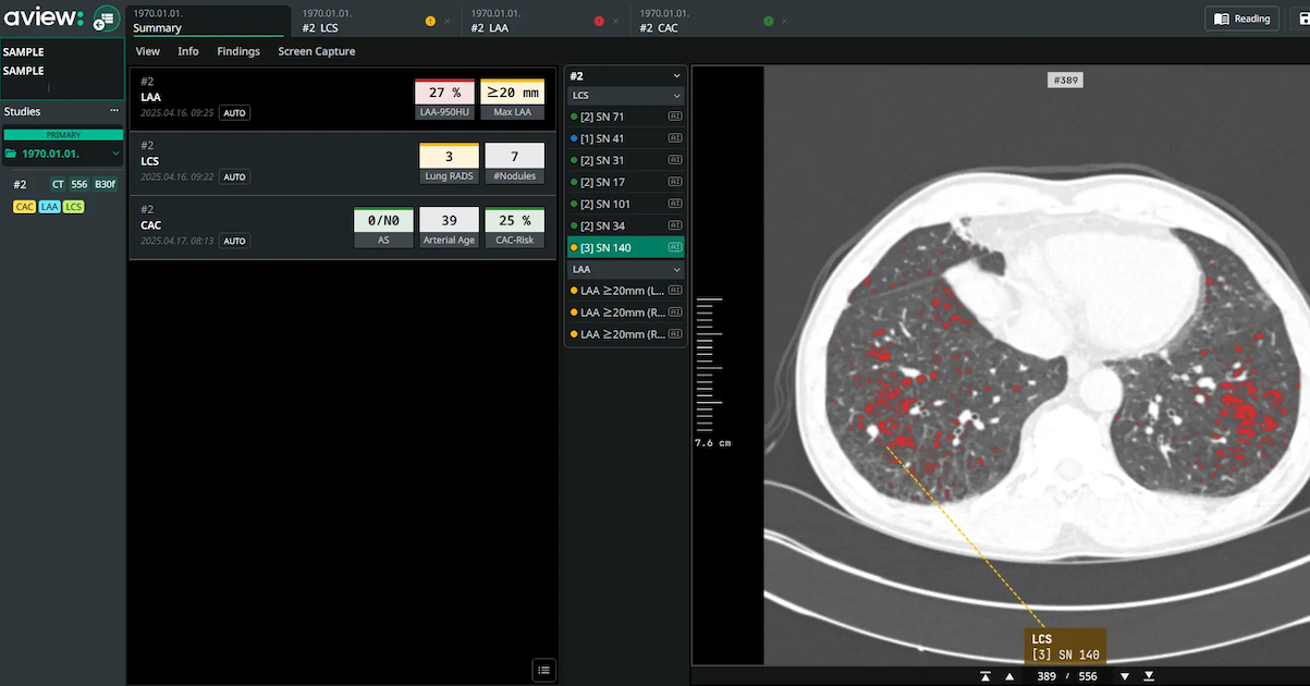 
  Interface of AVIEW LCS Plus desktop software
