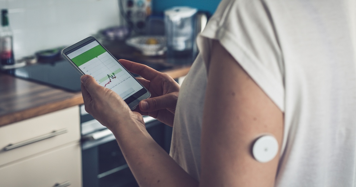 
  Photo of glucose monitor patch
