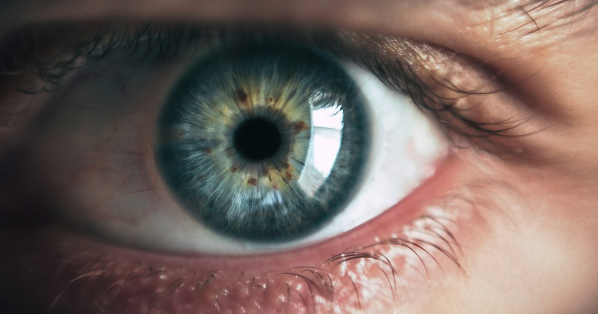 
  Photo of an eye

