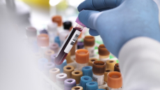 Test tubes in a lab