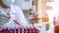 A laboratory technician analysing a blood sample