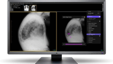 Harrison.ai's flagship product Annalise CXR
