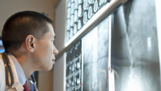 Healthcare provider looking at X-rays on a wall