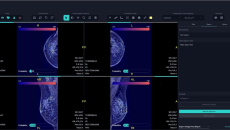 An interface of FxMammo, the AI breast cancer screening support solution by FathomX