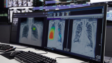 A reading from the Lunit INSIGHT CXR