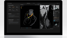 A desktop view of Artrya's Salix software