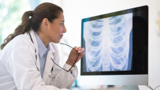Doctor looking at a chest x-ray