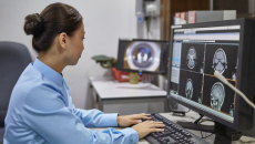 A radiologist looking at brain scans