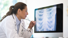 A doctor assessing a chest X-ray scan