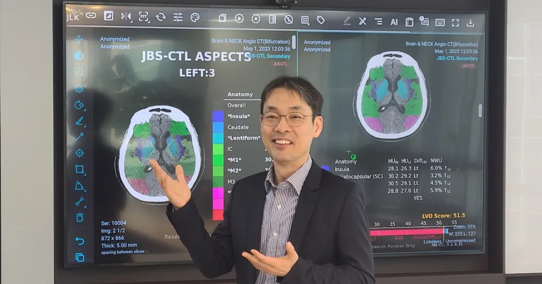 
  JLK CEO Dong-Min Kim showcasing their stroke AI solution

