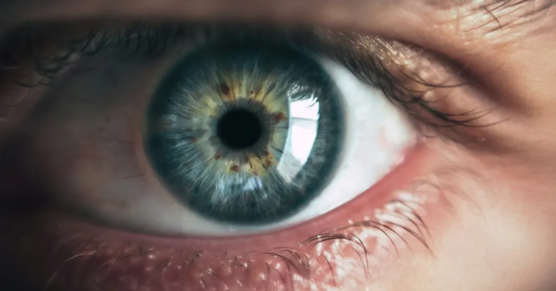 Photo of an eye
Photo of an eye