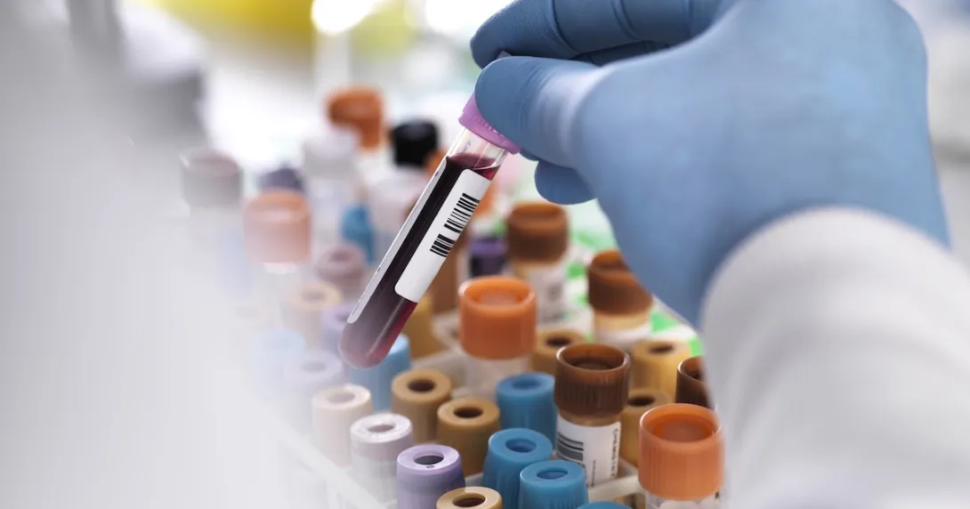 Test tubes in a lab