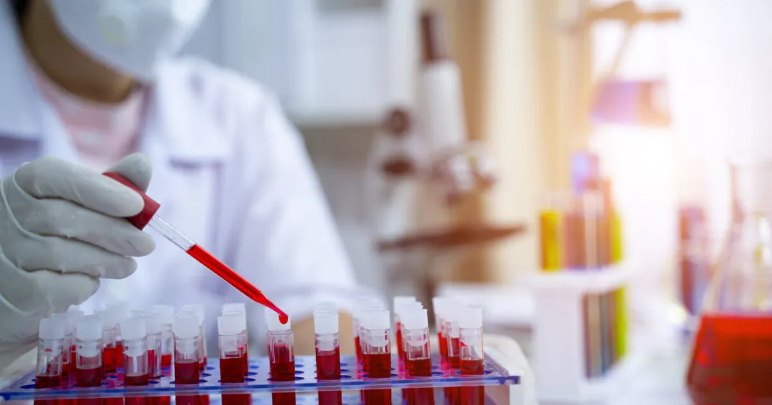 A laboratory technician analysing a blood sample