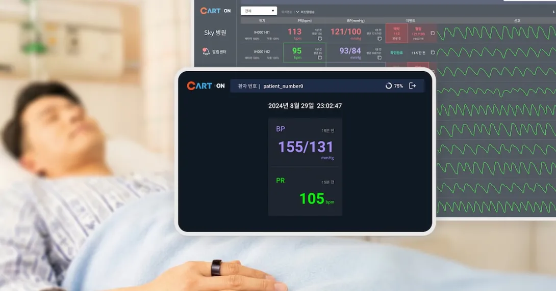 Sky Labs launches ward-specific blood pressure monitor ring