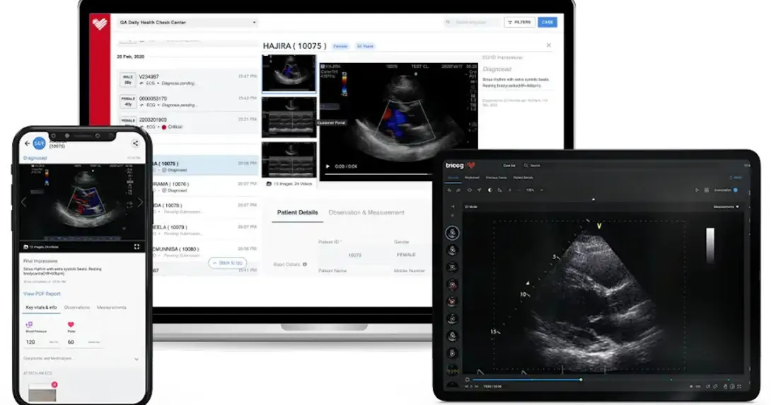 Tricog's InstaEcho app on various devices