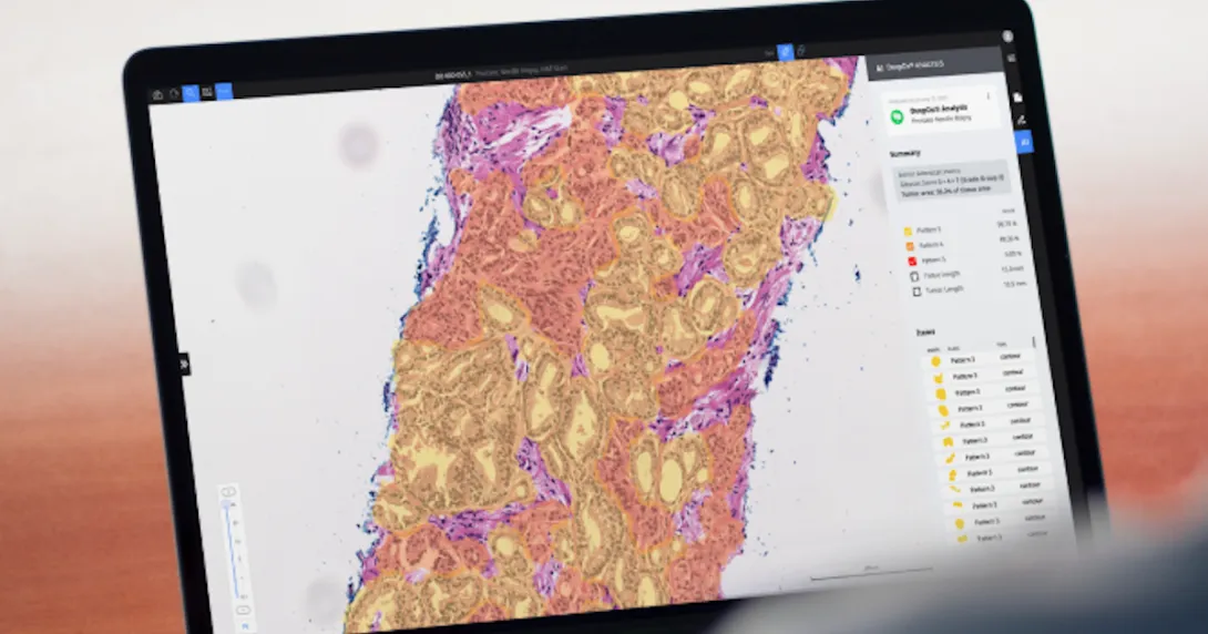 Deep Bio's prostate cancer analysis AI