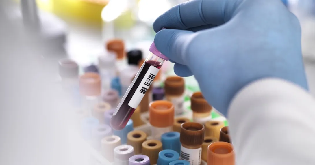 Closeup of test tube