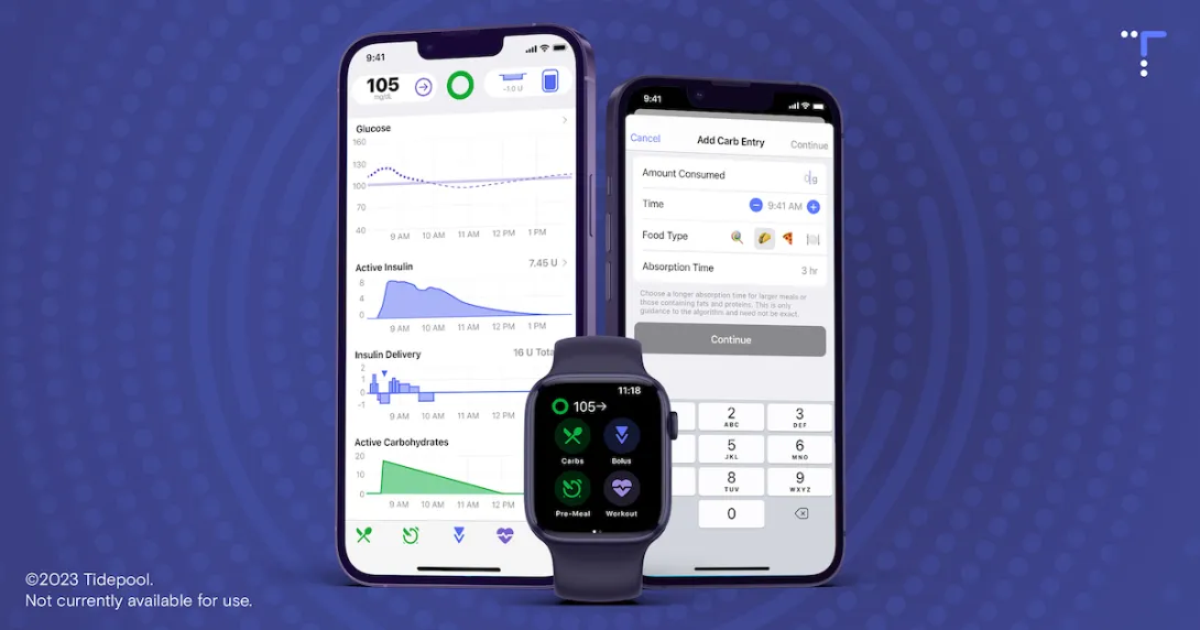 Tidepool Loop application on a phone
