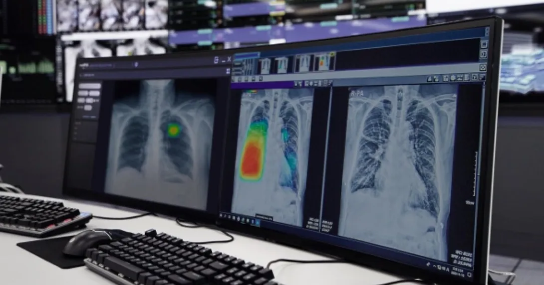 Desktop view of the Lunit INSIGHT CXR