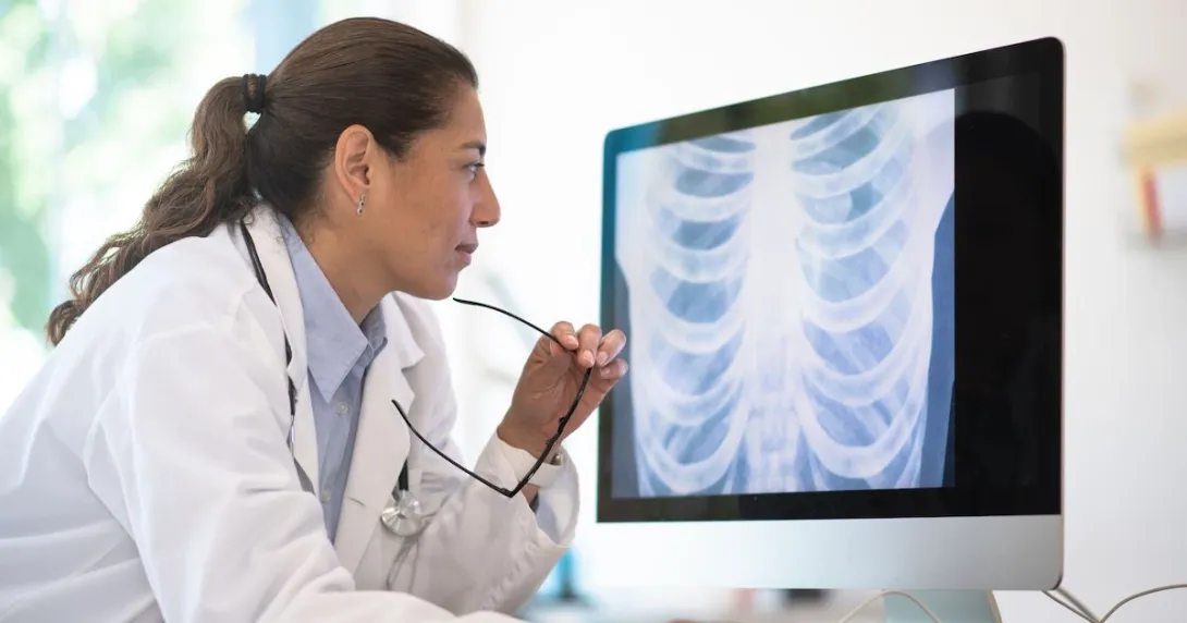 A doctor looking at a chest x-ray