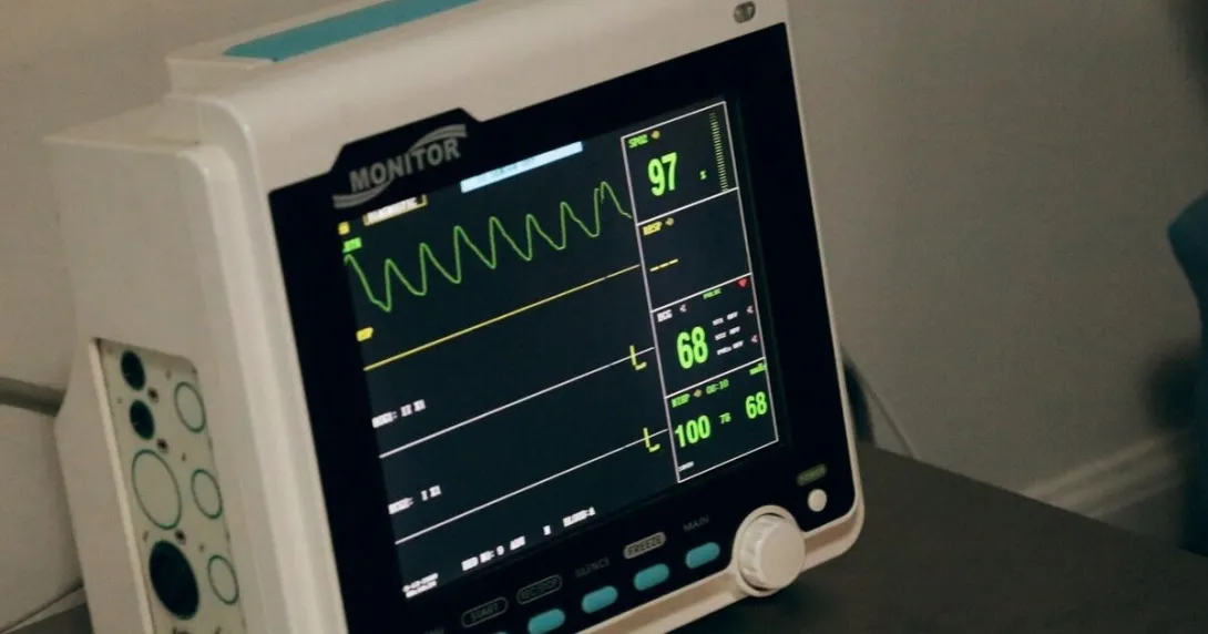 An ECG monitor