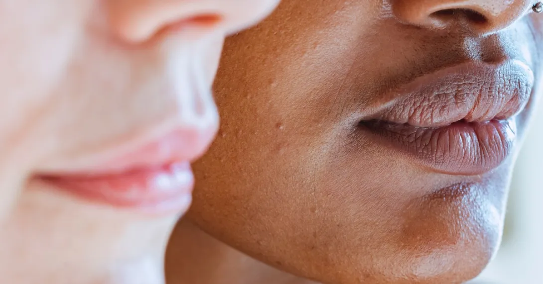 skin health